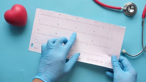 Hands in Gloves Examining EKG Readout