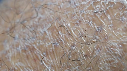 Human Skin Texture