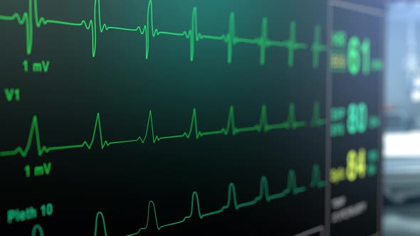 Patient Monitor Displays Vital Signs ECG Electrocardiogram EKG, Oxygen ...