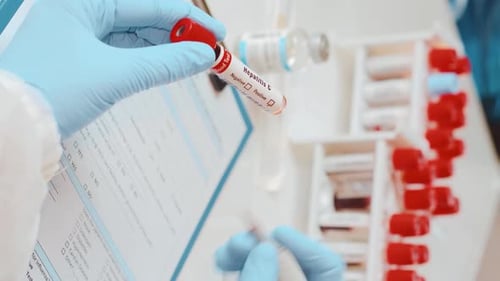 Positive Hepatitis C Blood Test Close Up