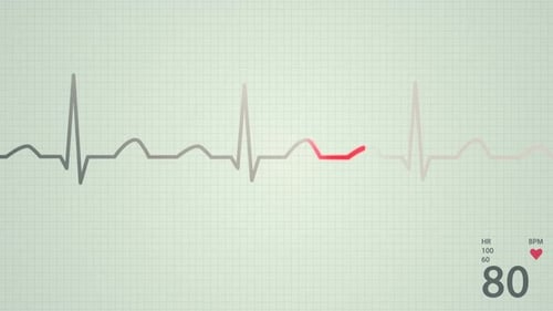 Animation of a schematic diagram of normal sinus rhythm for a human heart