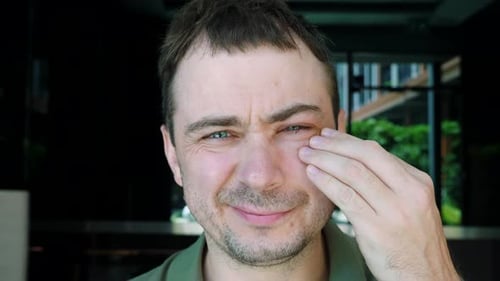 Man with Eye Bruise Shiner Feeling Pain Touching Eyelid Inflammation By Hand