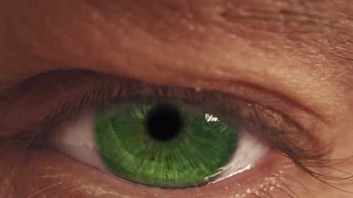 An One Eye of Old Man with Red Capillaries