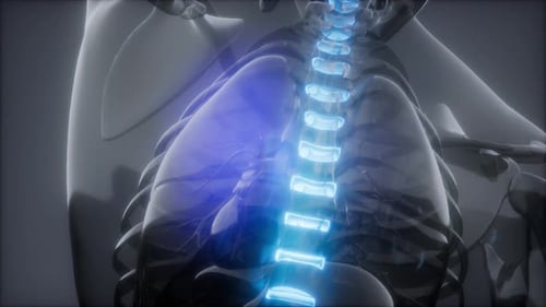 Backache in Back Bones