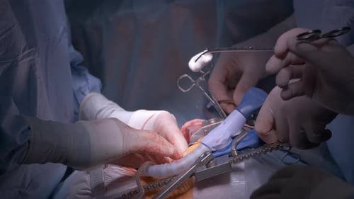 Medical Procedure in Hospital Operating Room