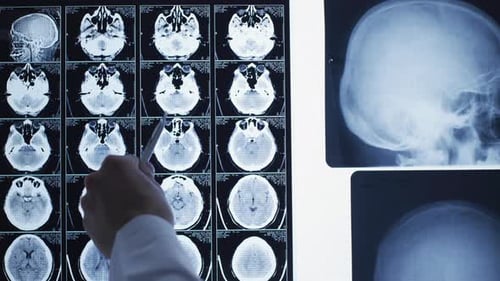 Examining x-ray images