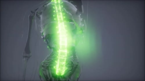 Backache in Back Bones