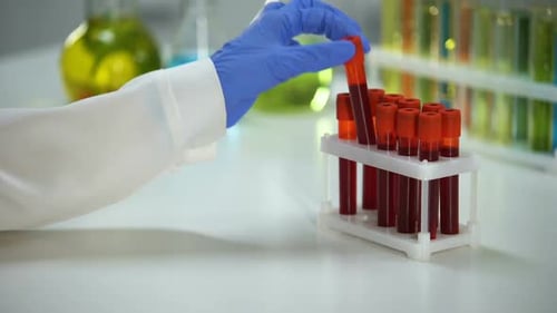 Taking Blood Sample in the Lab