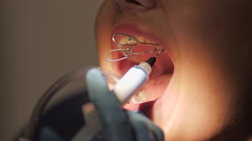 Dental Procedure Close-Up