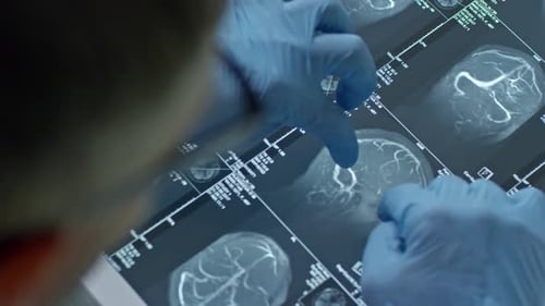 Arzt untersucht CT-Scan des Gehirns