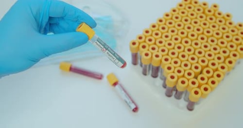 Gloved Hand Holding Negative COVID-19 Blood Test Vial