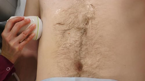 Ultrasonografía en el hospital. Vista lateral del procedimiento de ecografía del abdomen. Doctora que usa ECHO