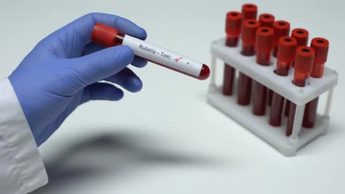 Röteln-Test, Arzt zeigt Blutprobe, Laborforschung, Gesundheitsuntersuchung
