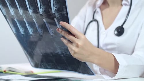 Radiologue médecin examinant une radiographie
