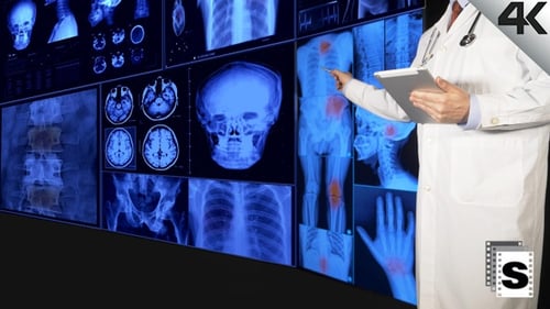 Doctor Analyzing X-Rays with a Tablet in Hospital