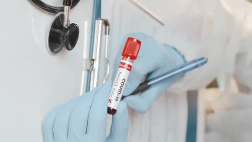 Healthcare Professional Analyzing COVID-19 Blood Test Sample