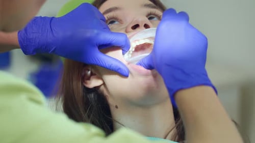 Dentist Preparing Patient Oral Cavity for Teeth Whitening Procedure