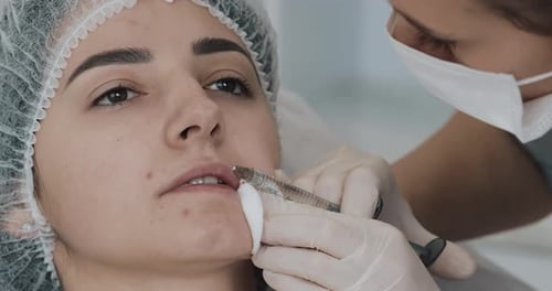 Woman Receiving Lip Filler Injection in Clinical Setting