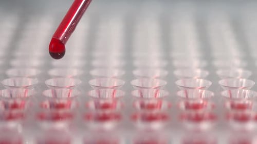 Blood Test