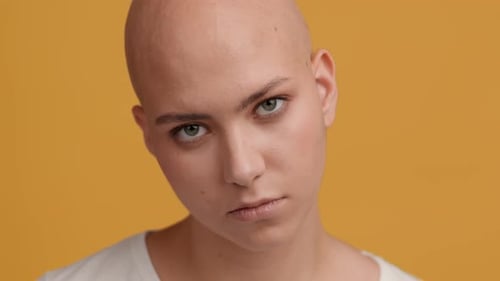 Serious BaldHeaded Female Posing Looking At Camera Over Yellow Background