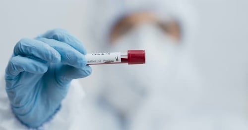 Close Up of Doctor Hands Holding Test Tube with Positive COVID-19 Result, Laboratory Research