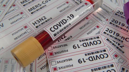 Blood Samples Testing Positive and Negative for COVID-19