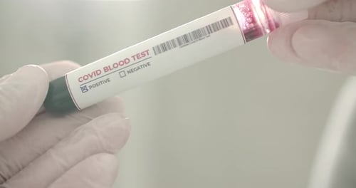 Blood Test