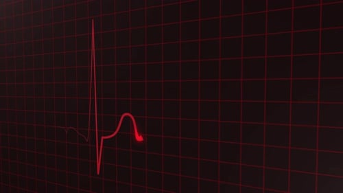 Animated Red ECG Heartbeat Pulse Line on Medical Monitor Grid