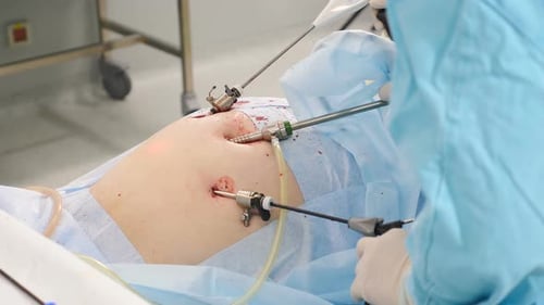 Laparoscopic Surgery