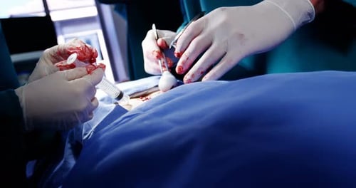 Close-up of surgeons performing operation in operation room