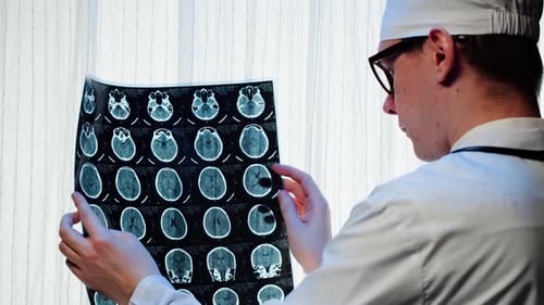Doctor Reviews Brain Scan in Hospital Office