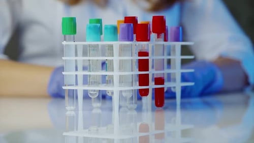 Pharmaceutical and scientific research. Close up of lab technician holding tube with blood