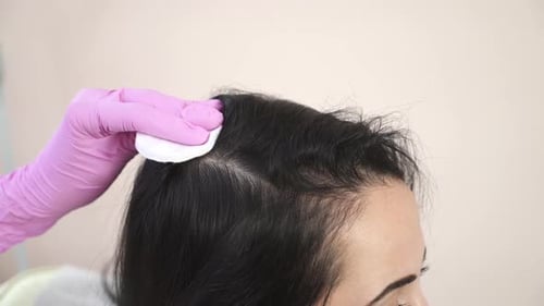 Needle mesotherapy. Cosmetic been injected in woman's head.