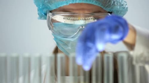Tube de marquage de travailleur de laboratoire médical avec l'échantillon d'urine, vérifiant le niveau de bilirubine