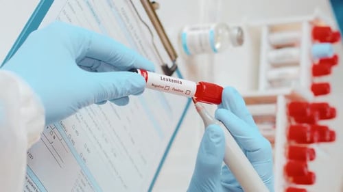 Vertical Footage of Doctor Holds Hand Blood Sample Tube for Leukemia Cells Test