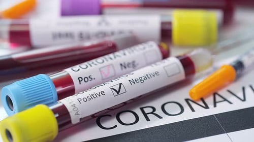 Marking Coronavirus Test Result as Negative