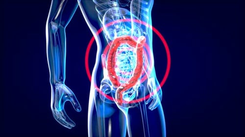 3D Human Colon Pain or Inflammation Medical Animation