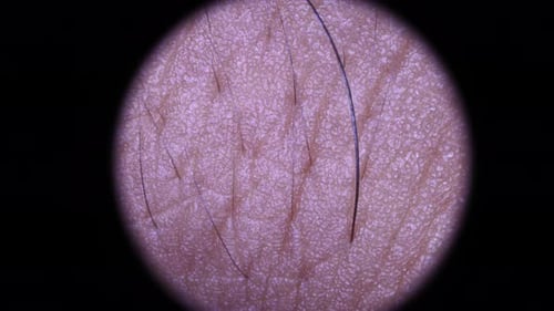 Extreme Close Up View of Human Skin and Hair