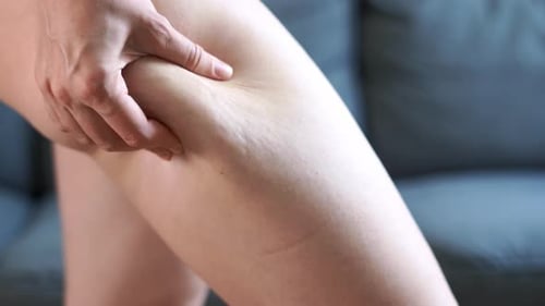 Quadril feminino com celulites. Problema de figura, massagem de beleza.