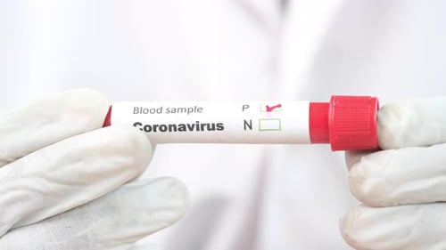 Hand in medizinischen Handschuhen mit Blutteströhrchen