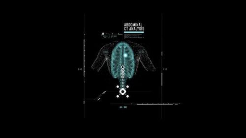 Futuristic HUD Medical Abdominal Scan Analysis