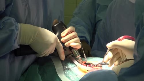 Surgeons performing a Delicate Operation in Hospital Setting