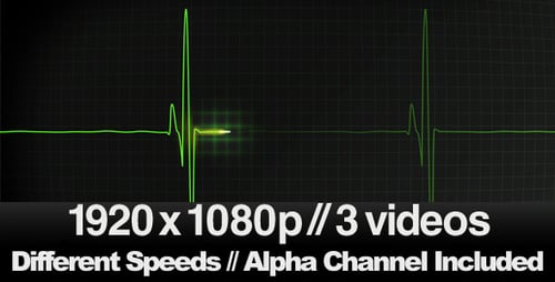 Animated ECG Heartbeat Line Monitor with Flatline Effect