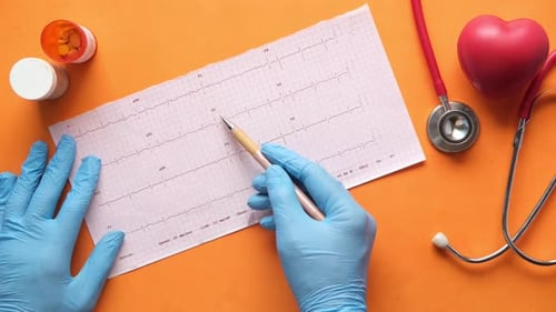 Doktor Hand in medizinischen Handschuhen zur Analyse des Kardio-Diagramms