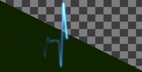Glowing Neon ECG Heartbeat Line Animations Set