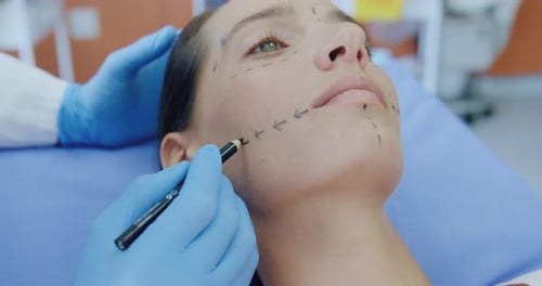 Facial Markings for Cosmetic Procedure