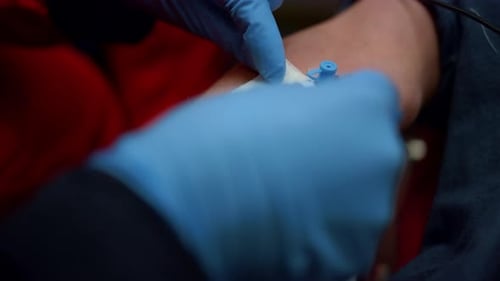 Close Up of IV Being Set in Arm