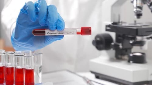 A Doctor Is Testing Blood for Infection with a New Coronavirus From China