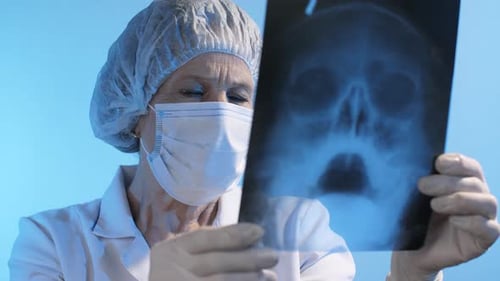 Arzt untersucht Röntgenaufnahme des Schädels