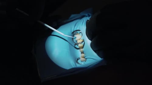 Close Up Dentistry with Gloved Hands